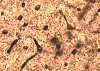 bone marrow through a microscope