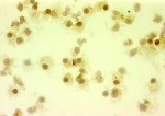 tumors in tissue serum_feature