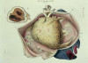 L0033474 Diseases of the heart