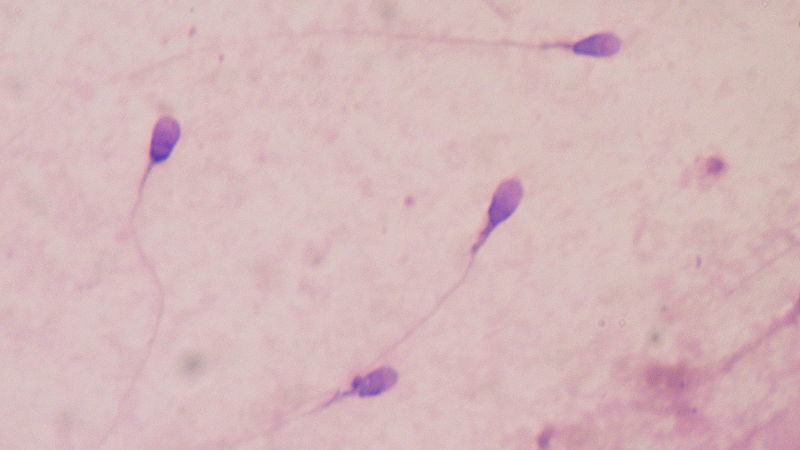 Human sperm, stained pink